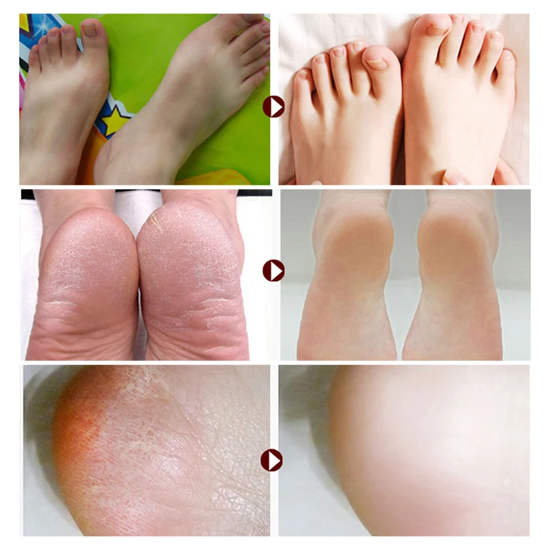 Handle Type Foot File Scraper Portable Multifunctional Foot File Foot Care Tools Dead Skin Remover Pedicure
