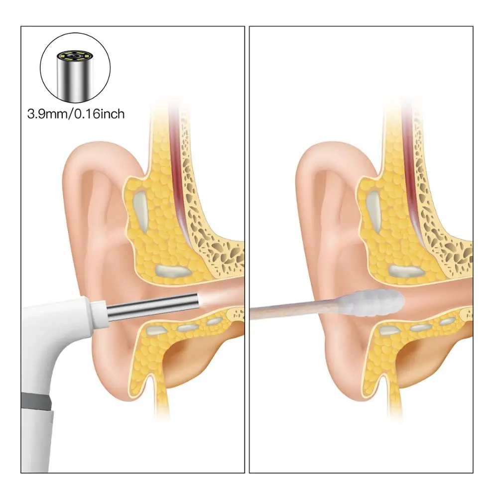 5 в 1 Wifi эндоскоп 1MP 1080p HD визуальная Ушная ложка Earpick 3,9 мм двойная камера объектив Android PC ушной отоскоп для Android PC IOS