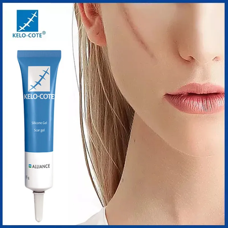 pigmentation & acne scar removal cream