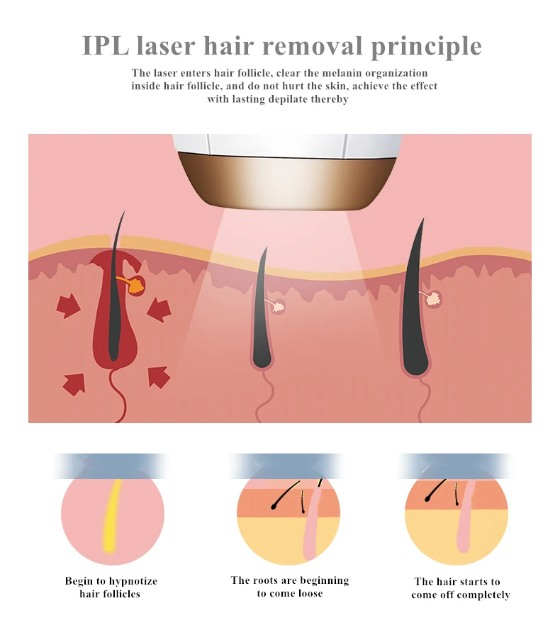 IPL лазерная Машинка для удаления волос, лазерный эпилятор для удаления волос, триммер для постоянного бикини, Электрический депилятор с солнцезащитными очками