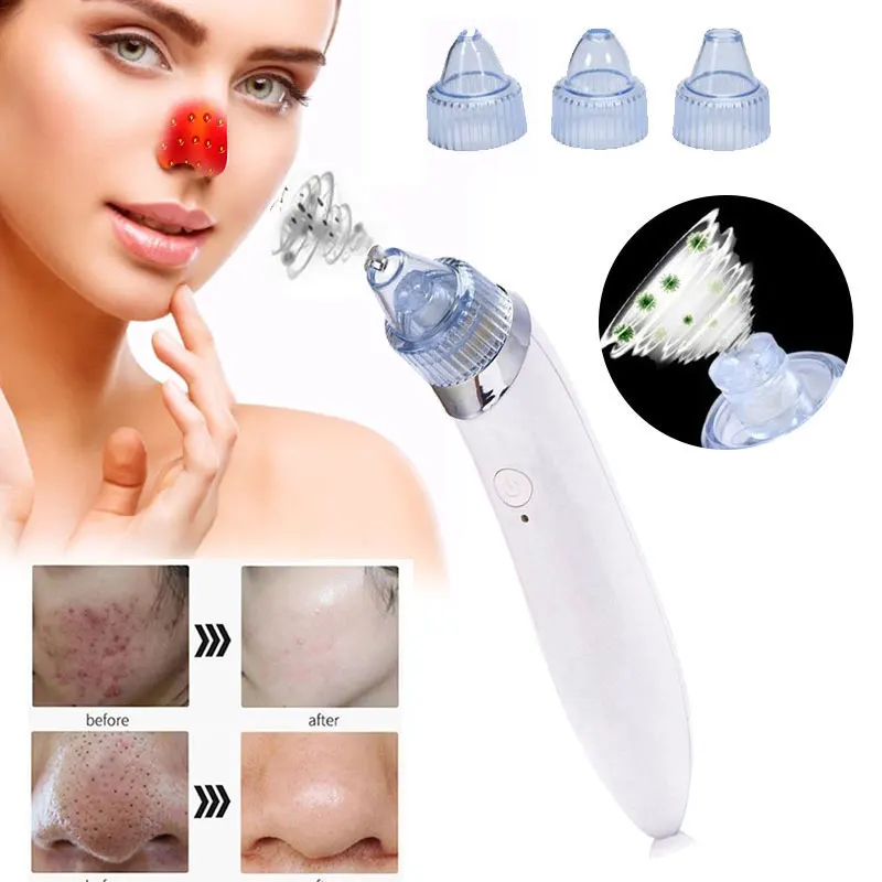 

Acne Cleaner Black Head Cleaner Blackhead Removal Equipment Fast Fashion White ABS Beauty Remove Pore Contraction Skin Care