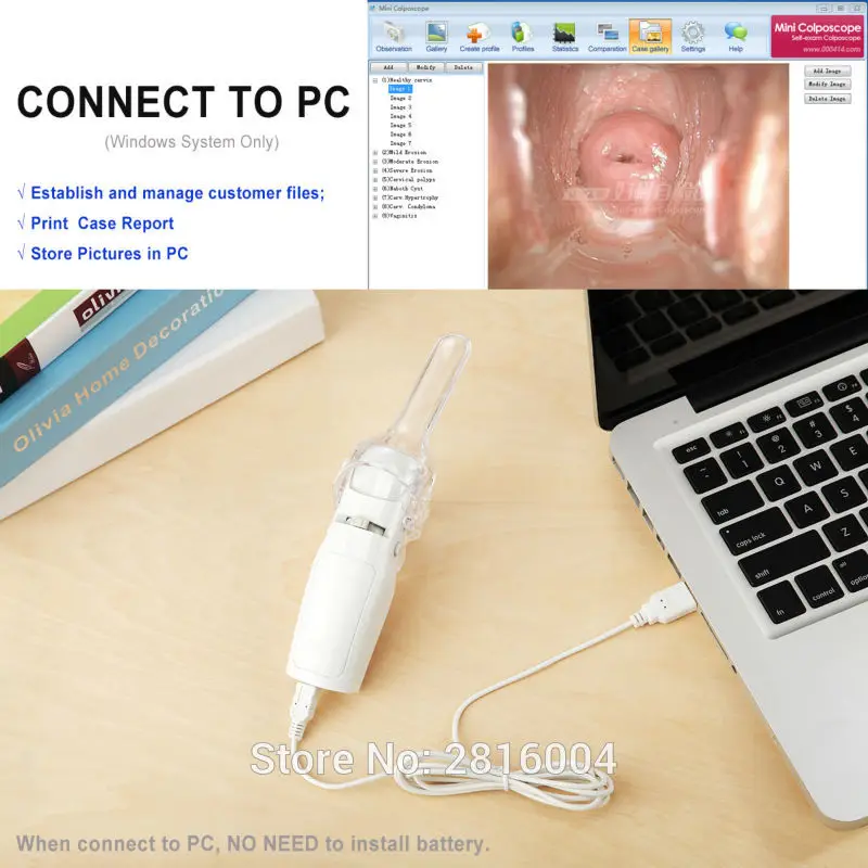  Portable Digital Video Electronic Mini Colposcope FA2 with 3000000 Pixels Camera Endoscope Gynecolo