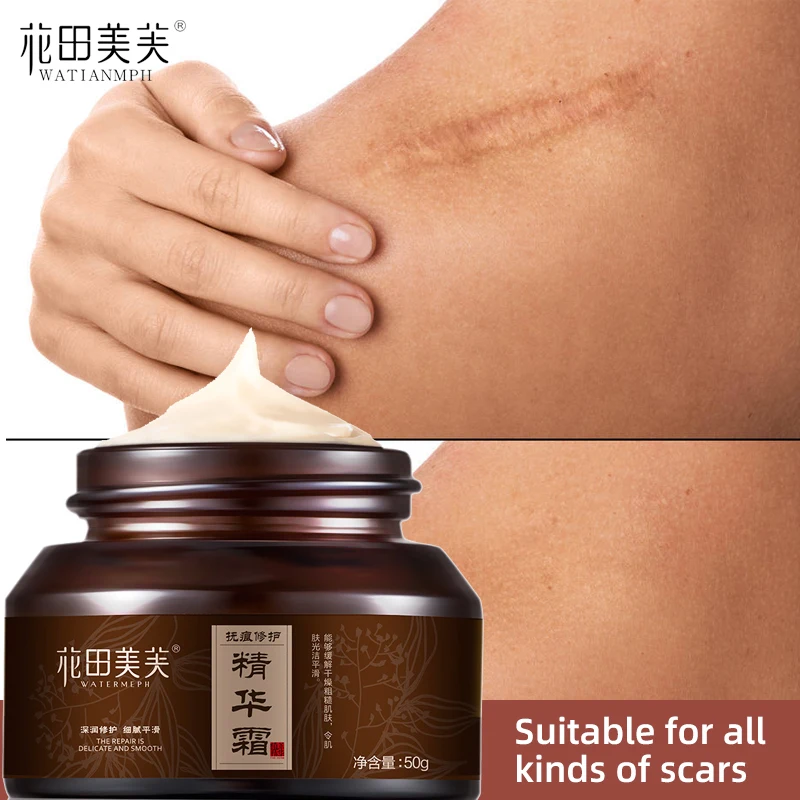 SHILAIGE крем для удаления шрамов от акне старого шрама кесарева сечения шрамы