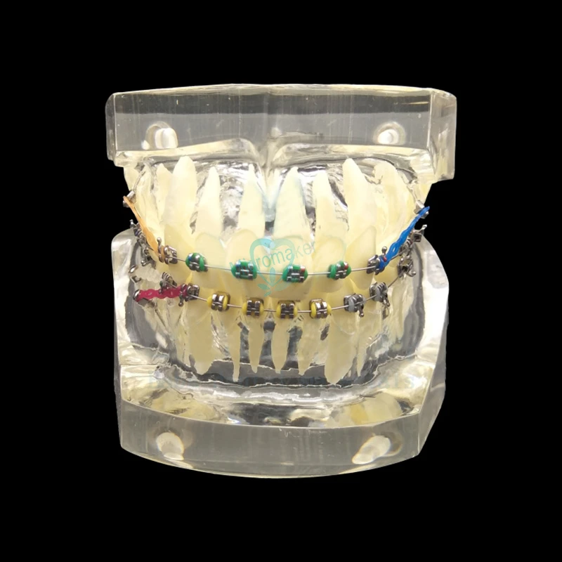 1 шт. Стоматологическая Ортодонтическая Учебная модель зубной ортодонтический с красочными кронштейнами для аккуратных и неправильных моделей на выбор