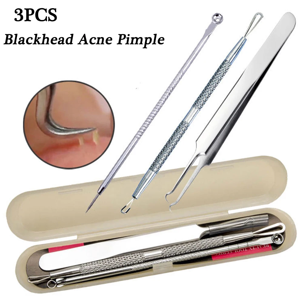 3-5pcs Double-head Acne Extractor Remover Tools Kit Stainless Steel Blackhead Pimple Needles Treatments Face Clean Tool 3-5pcs Double-head Acne Extractor Remover Tools Kit Stainless Steel Blackhead Pimple Needles Treatments Face Clean Tool