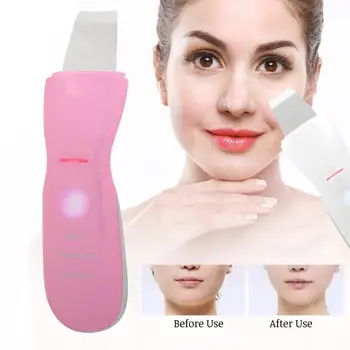 

Ultrasonic Skin Scrubber Blackhead Pimple Removal Pore Cleanser Ion Serum Import Instrument Face Skin Scrubber