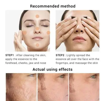 

10ml Hyaluronic Acid Serum Moisturizing Shrink Pore face Face Whitening care skin U2E4