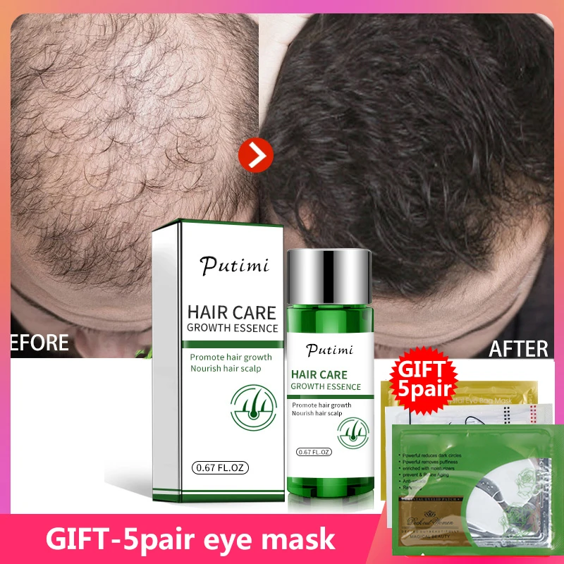 Putimi-20ml-Hair-Growth-Serum-Ginger-Essence-Beard-Hair-Growth-Serum-Anti-Hair-Loss-Product-for