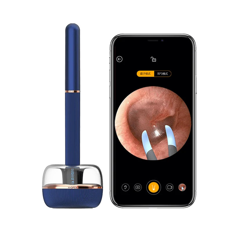 Bebird smart. Умная ушная палочка xiaomi bebird. xiaomi bebird smart visual ear stick note 3. xiaomi bebird умный очиститель для ушей. прибор для чистки ушей xiaomi bebird.
