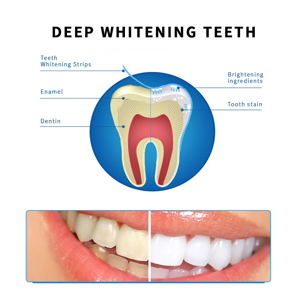 1/2 пар белого цвета гель для отбеливания зубов полоски зубные полоски для удаления пятен гигиены ротовой полости полосы для отбеливания зубов инструмент для отбеливания зубов