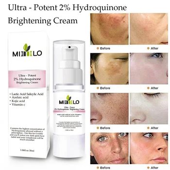 

Strong effect Facial whitening cream Remove Freckle melasma Acne Spots Brighten Skin Moisturizing Firming Skin Face care cream