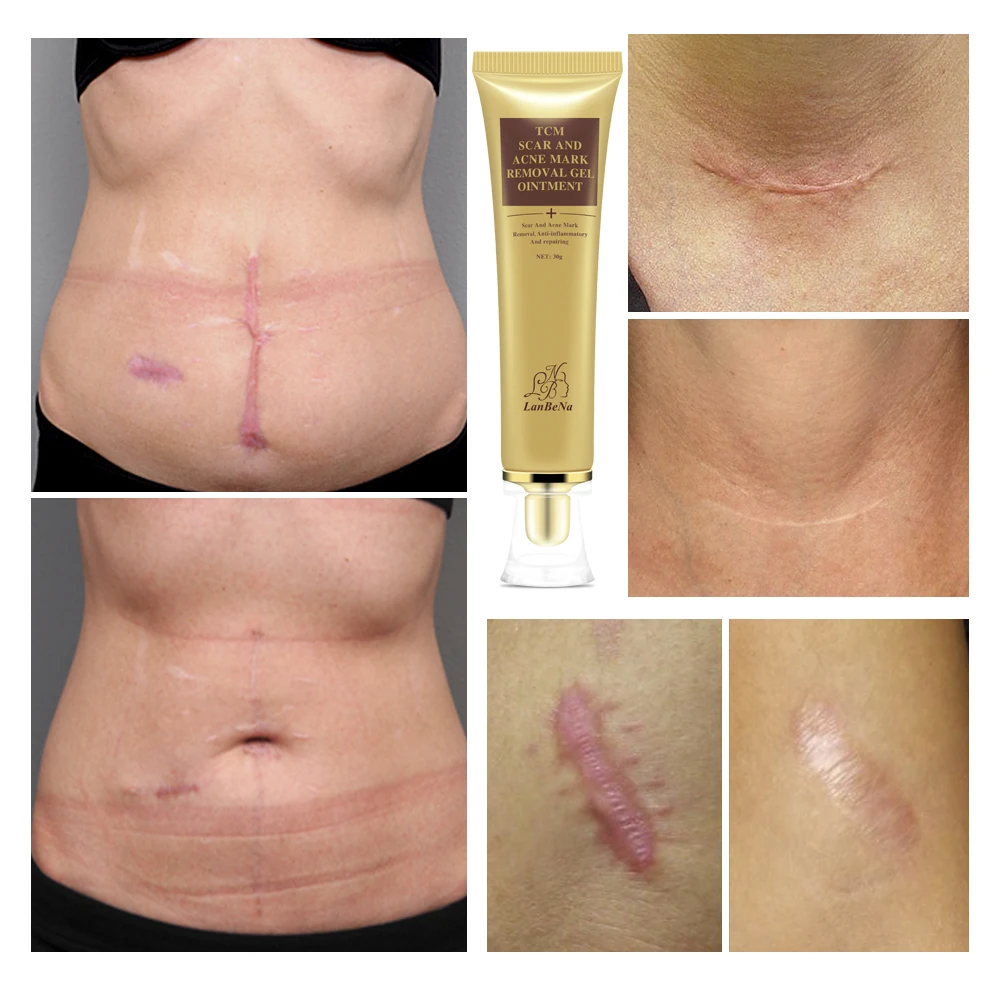 3c31d292-68b3-8cc6-f0ef-31bab9888a0c