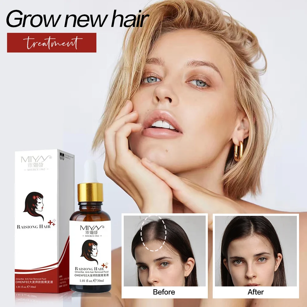 2pcs Hair Growth Essence Essential Oil Natural Herbal Hair Growth Treatment Serum Anti Hair Loss Hair Care Products Hair Tonic
