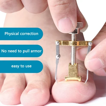 

Paronychia Ingrown Toe Nail Fixer Pedicure Recover Embed Toenail Correction Lifter Tool Orthodontic Inlay Corrector Pedicure Set