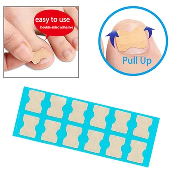 

Ingrown Toenail Correction Tool Toe Nail Treatment Elastic Patch Sticker Clip