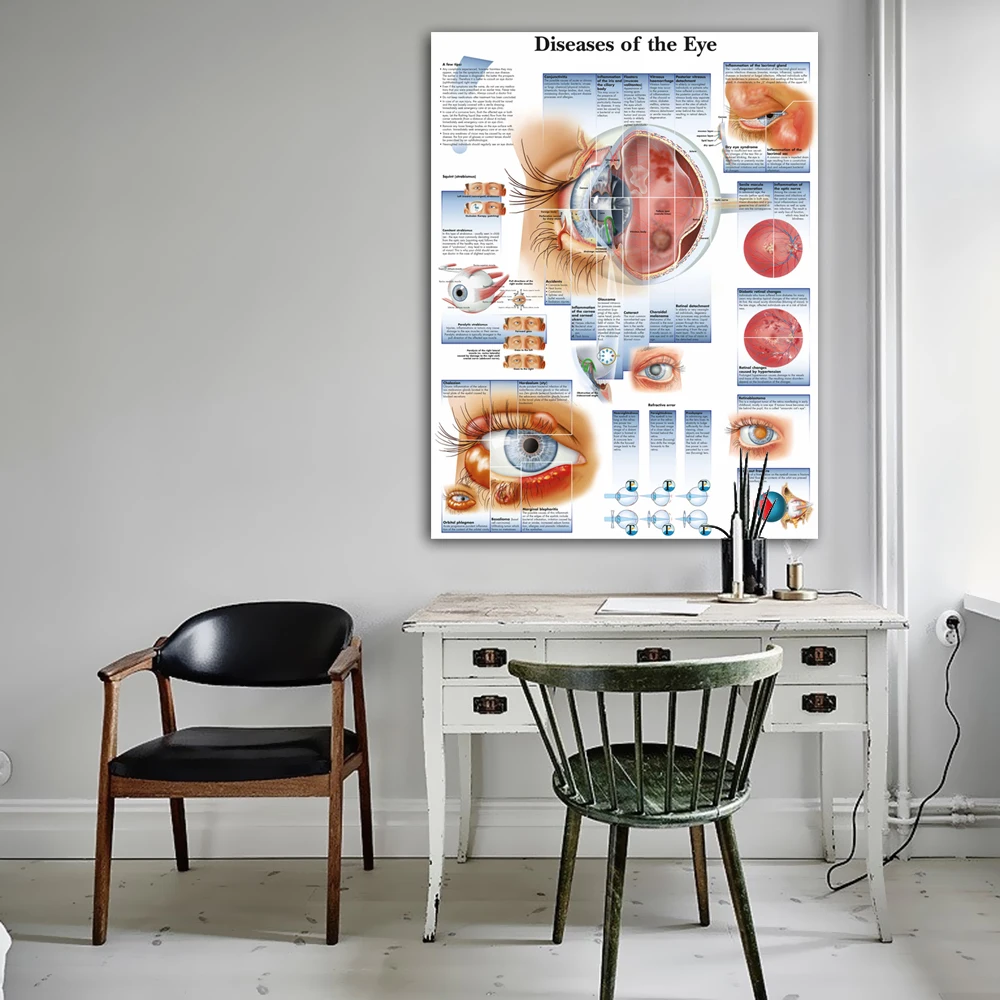 Kaufen WANGART Poster Krankheiten der Eye Chart Poster Refractiv Leinwand druck Wand Bilder für Medizinische Bildung Wohnkultur