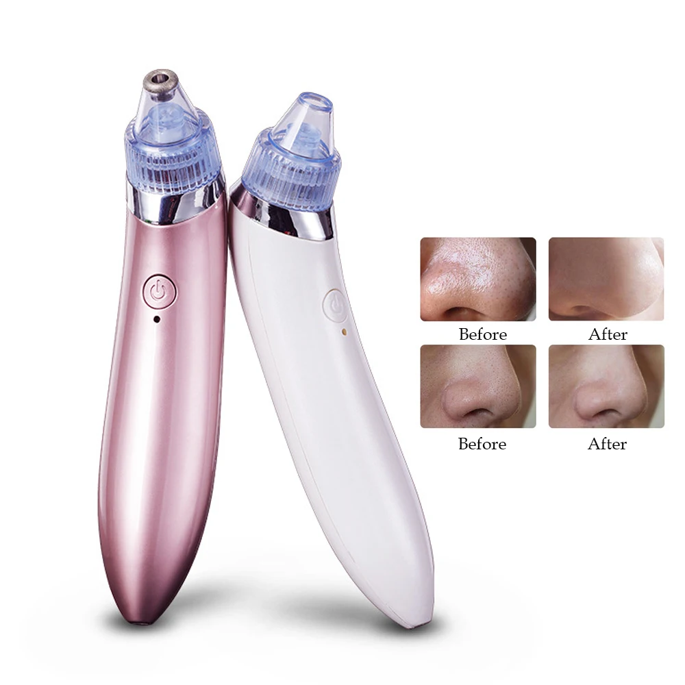 best ordinary products for redness