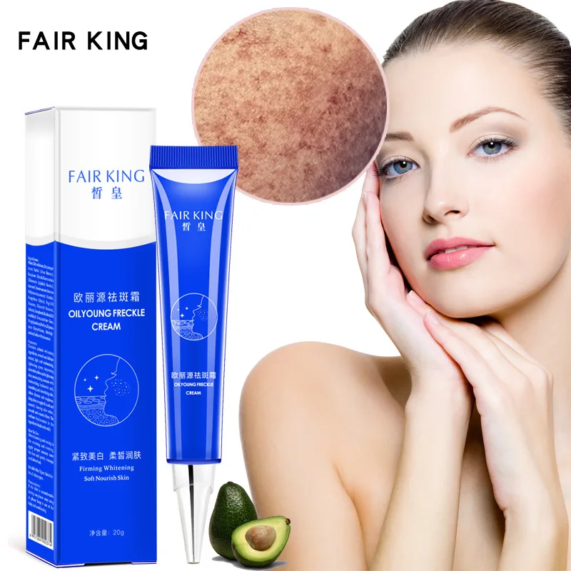 Powerful Effective Whitening Freckle Cream Moisturizing Remove Melasma Acne Spots Treatment Melanin Pigment Facial Care | Красота и