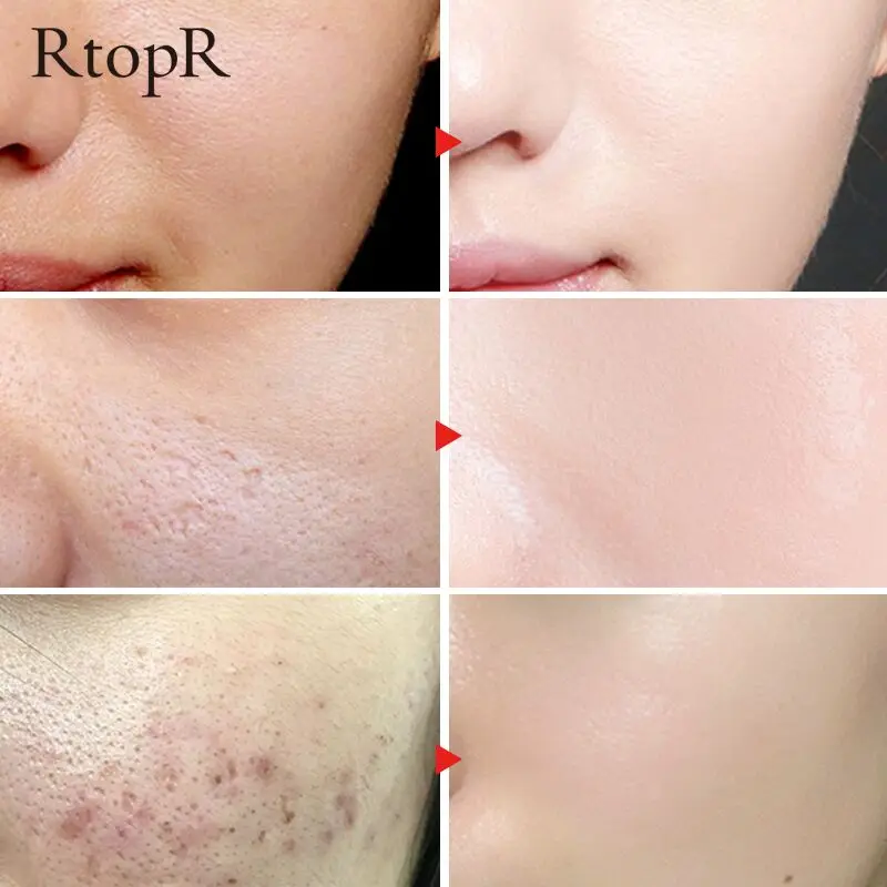 Горячая Распродажа RtopR Glycyrhiza восстанавливающая пор для лица Сыворотка коллаген