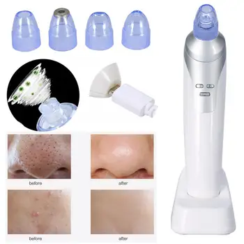 

Portable Facial Pore Cleaner Nose Blackhead Removal Vacuum Comedo Suction Tool Beauty Device Face Care Microdermabrasion Machine