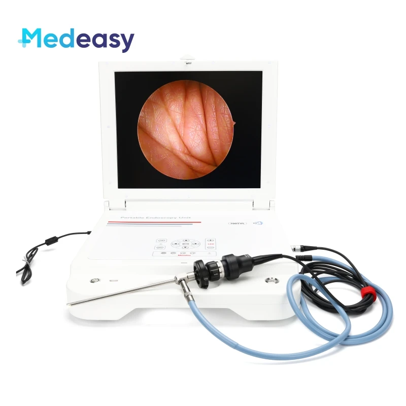 Multi-output Medical USB ENT Endoscope Camera Portable USB Endoscope Camera hd security camera