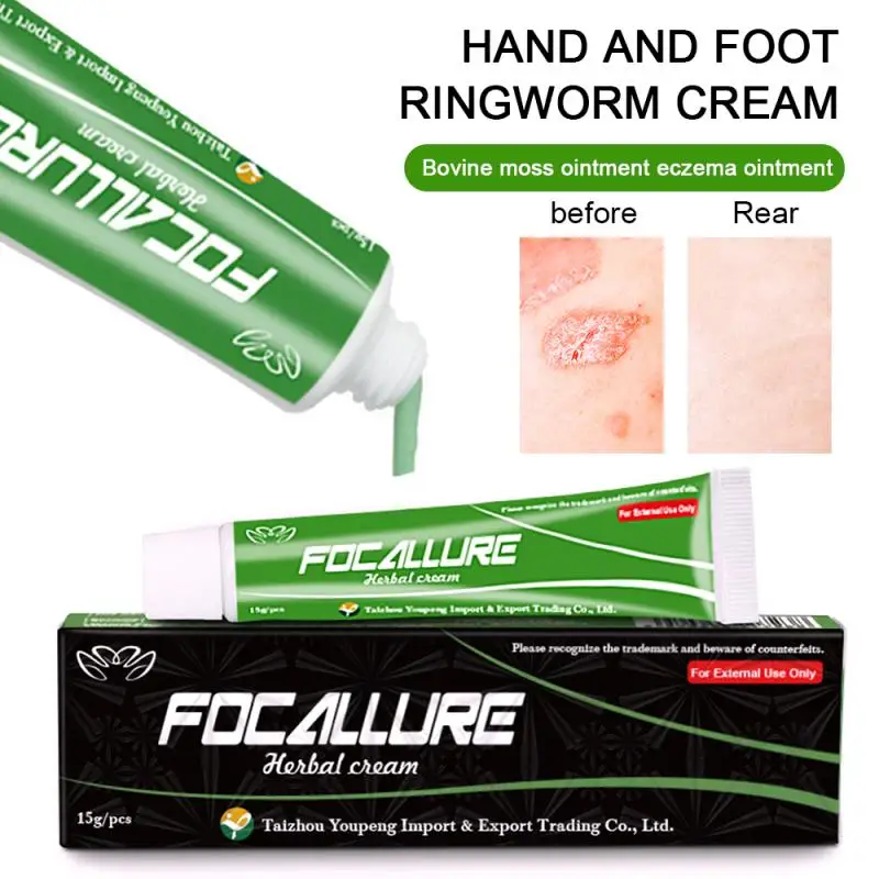 Ultra Strength YIGANERJING FOCALLURE Body Psoriasis Cream Dermatitis Eczematoid Eczema Ointment Treatment Balm 15g |