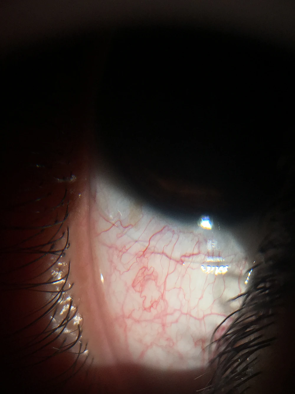 Ophthalmic Portable Slit Lamp All In One Handheld Type