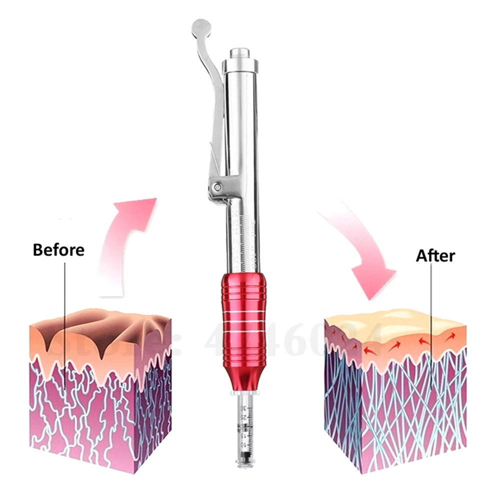 0,3 мл гиалурониковая ручка без игл для губ, наполнитель для губ, кислотная инъекционная ручка, мезо гиалуроновая ручка для подтягивания губ, против морщин, для кожи лица, автомобиля