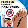 Anti-fungal Home Treatment Set Toe Nail Treatment Pen Onychomycosis Paronychia Anti Fungal Fungus Care Repair Serum Kit ► Photo 2/6