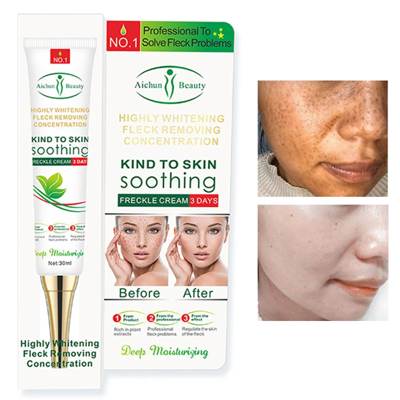 

Anti-Freckle Cream Moisturizing Whitening Nourish Remove Chloasma Freckles Age Spots Sunburn Dark Yellow Face Skin Care 30ml