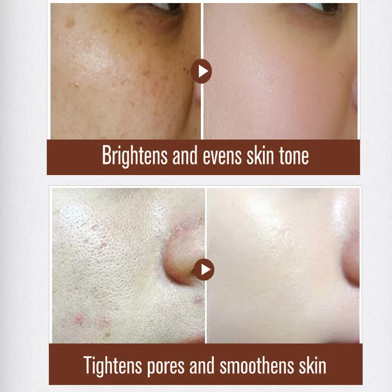 MEIKING Face Cream Acne Treatment Moisturizing Whitening Hydrating Shrink Pores Skin Care Collagen Day Creams Scar Remove|cream ingredient|cream