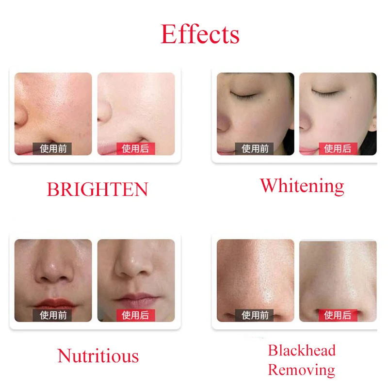 50ml 3 Bottle/Set Clean Solution Solution Facial Serum For Dermabrasion Skin Care Machine