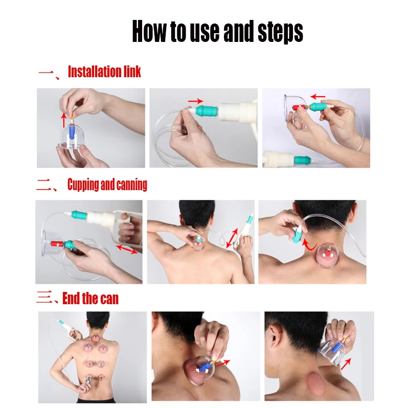 vacuum cupping cups (3)