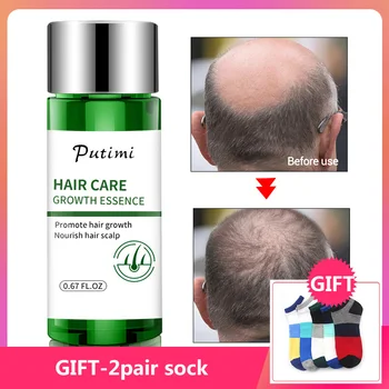 

PUTIMI Hair Serum Preventing Hair Loss Baldness Treatment Natural Ginger Extract Fast Growing Hair Growth Essence 20ml