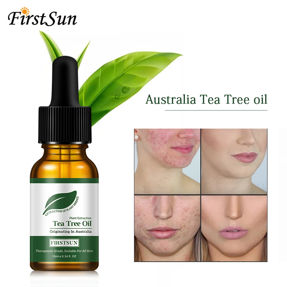 

100% Natural Tea Tree Essential Oil Anti-wrinkle Extract Acne Removal Scars Marks Treatment Essential Oil for Any Skin CareTSLM1