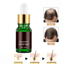 10 мл имбирное эфирное масло для роста волос для женщин и мужчин против выпадения волос лечение кожи головы мужчины t быстрый рост волос