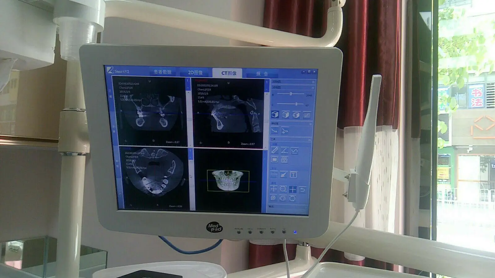  High Quality Dental Touch screen capacitive monitor with intraoral camera built in Intel/Windows10