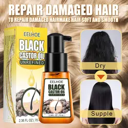 1pcs Black Castor Oil Dry Skin Hair Care Smooth Pure Essential Oil Suitable For All Hair Types Can Thicker Stronger Shiny Hair