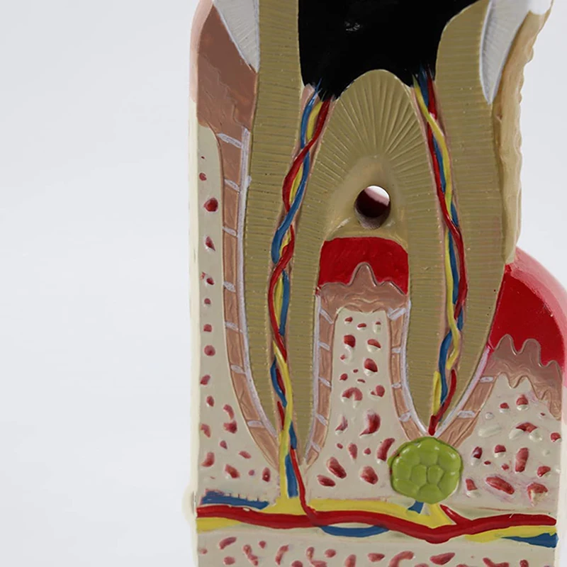 Tooth Pathological Disease Caries Medical Science Teaching Resources
