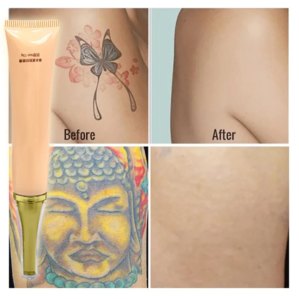 New-100-Safe-Permanent-Tattoo-Removal-Cream-Tattoo-Print-Cleaning-Cream-Applicable-on-Most-Parts-of (4)