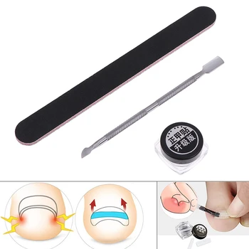 

1set Ingrown Toenail Correction Tool Set Nail Pedicure Elastic Patch Straightening Clip Brace Bunion Corrector