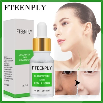 

FTEENPLY Hyaluronic Acid Facial Serum Oligopeptide Moisturizing and Repairing Dry Red Blood Serum Anti-acne Facial Treatment
