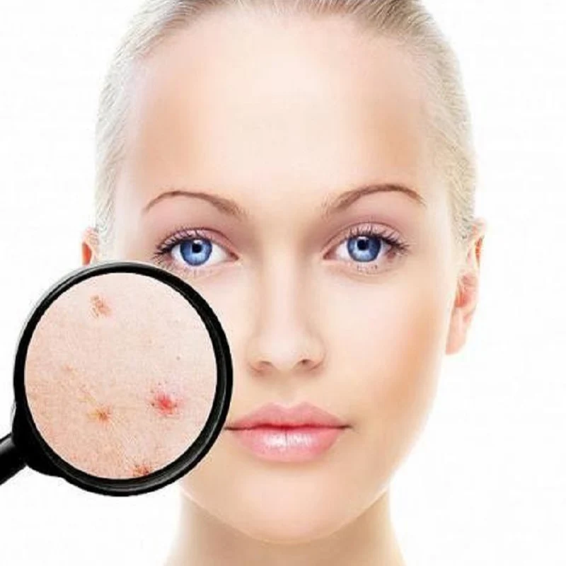 Skin Analyzer Electric Portable Facial Skin Detector Dermoscopy Tester For Diagnosis With 2 Lens