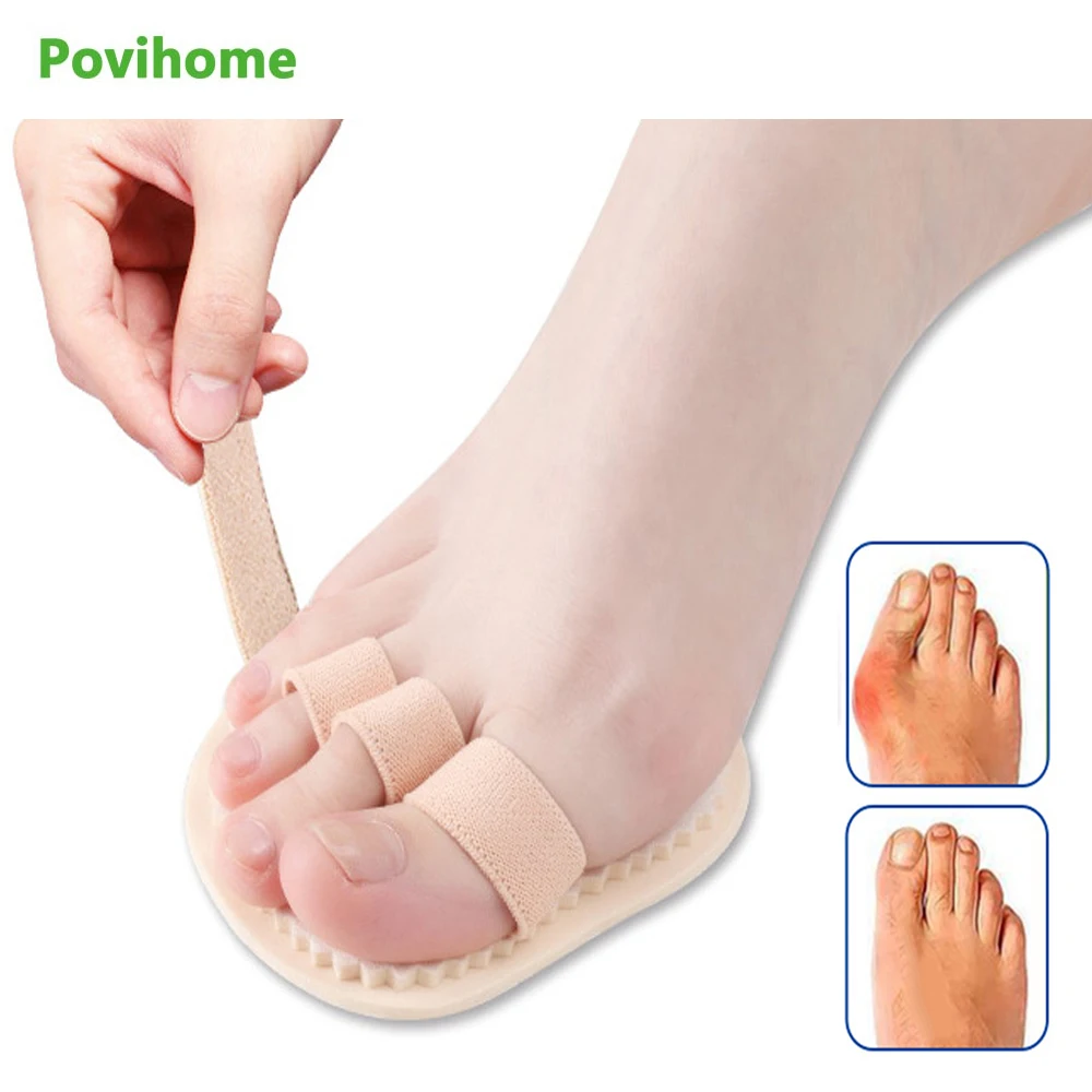 

2Pcs Foot Massager Bunion Toe Corrector Separator Hammer Hallux Valgus Tool Care Silicone Small Big Toe Sets Posture C171