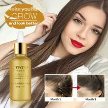 Быстрый рост волос сывороточная эссенция лечение выпадения волос продукты против выпадения волос Уход питание волос и бороды масло для роста