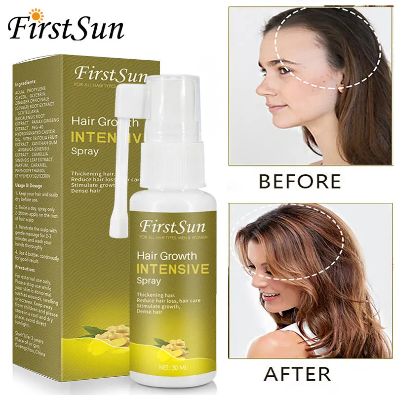 Ginger Hair Growth Spray Anti Loss Nourish Roots Thick Shiny Fast Growing Oil Health Care Beauty Dense Regrowth Serum | Красота и
