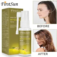 Ginger Hair Growth Spray Anti Hair Loss Nourish Roots Thick Shiny Fast Growing Oil Health Care Beauty Dense Hair Regrowth Serum