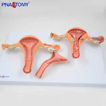 

Medical props model human Pathological Uterus Ovary Model Detachable Normal Uterus Model Anatomical Teaching Tool Medical Gift