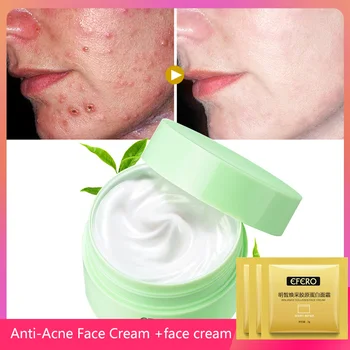 

EFERO Tea Tree Essence Anti-Acne Cream Remove Pimple Spot Whitening Moisturizing Day Cream Acne Treatment Face Skin Care 30g