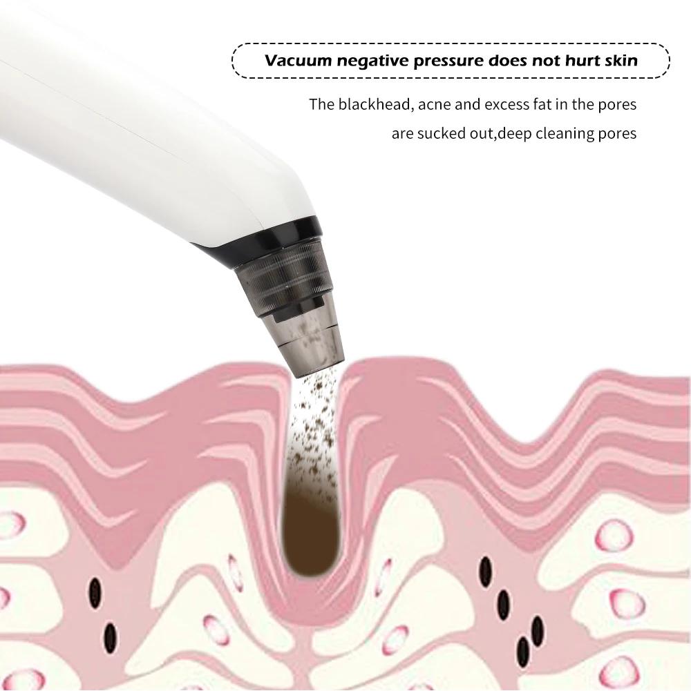 Removedor de Sucção Cuidados com a Pele Limpo com 5 Rosto Elétrico Nariz Vácuo Cravo Poros Espinha Acne Removedor Mais Dicas Ferramenta Facial 9 limpo com 5 dicas ferramenta cuidados com a pele facial